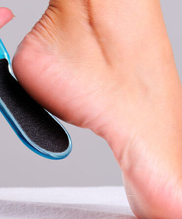 Como remover os calos dos pés de forma segura